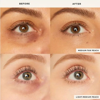 Luminous Eye Revive™